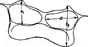 Рис. 2. Промеры на первом восковом нижнем полуколечке (стерните). 22 — длина