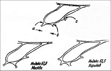 Рис. 7. Промеры длины жилок, ограничивающих кубитальную ячейку крыла. Промер